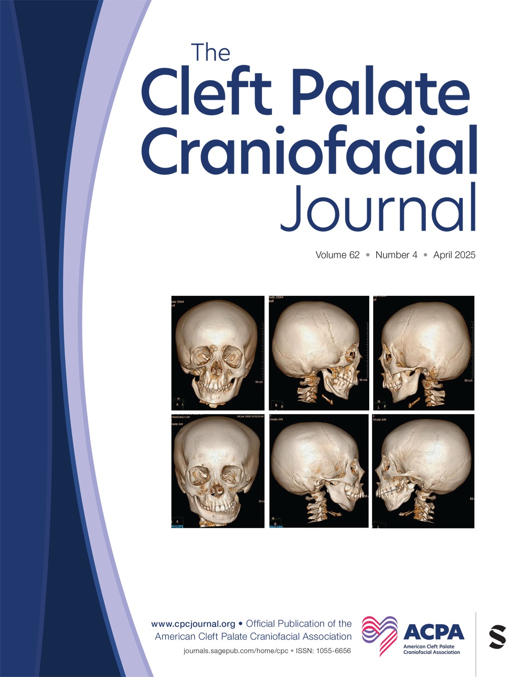 Cleft Palate-Craniofacial Journal