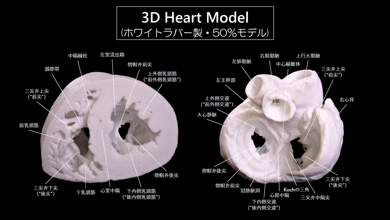 3d Heart Model (White Rubber, 50%)