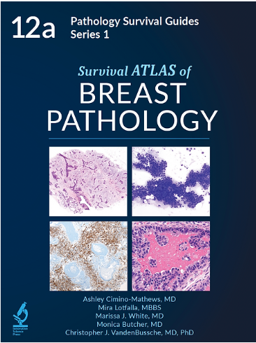 Pathology Survival Guides, Series 1Vol.12a: Survival Atlas of Breast Pathology