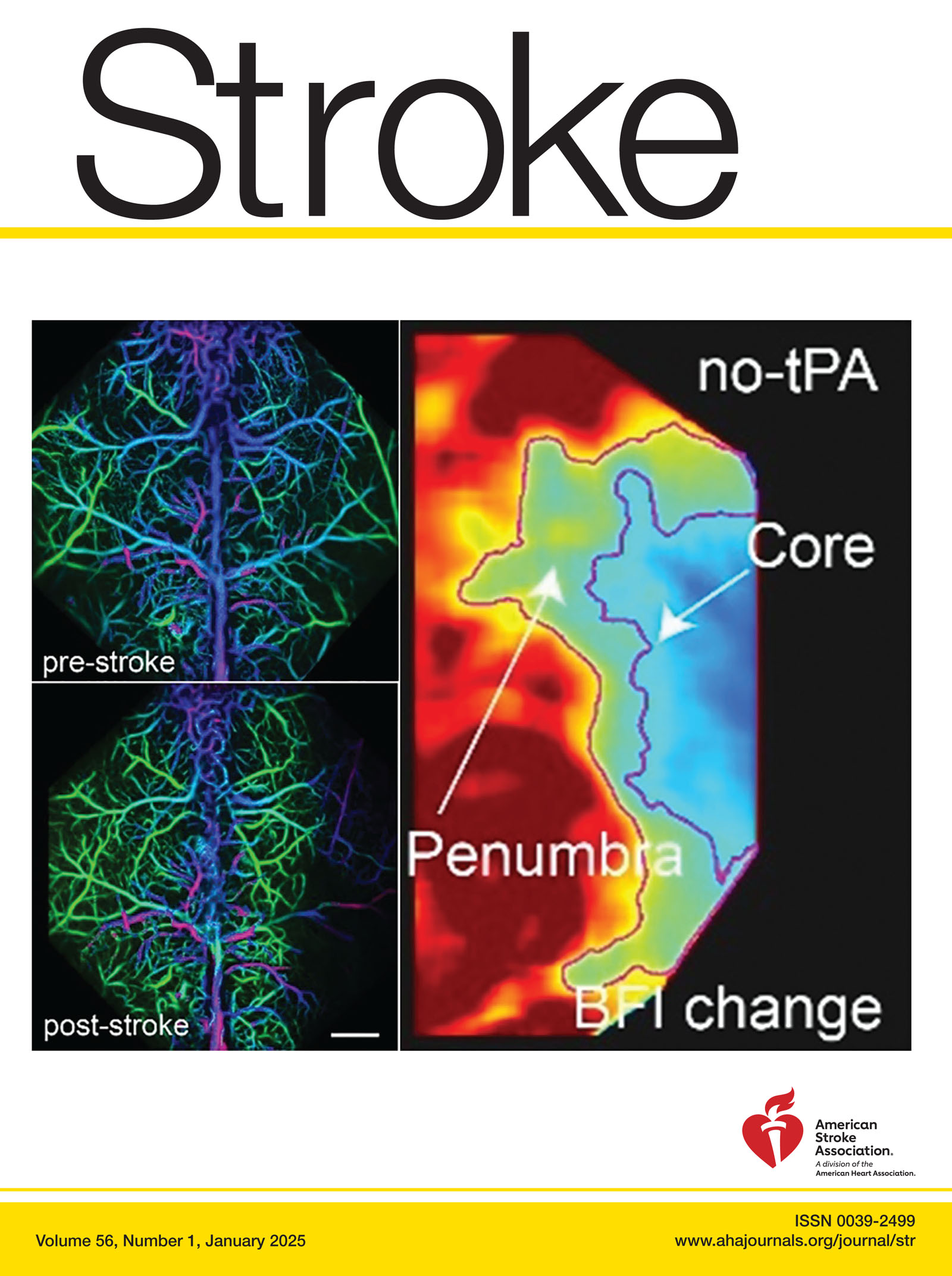 Stroke-Journal of Cerebral Circulation