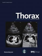 Thorax