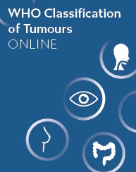 WHO Classification of Tumours Online