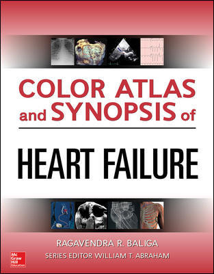 Color Atlas & Synopsis of Heart Failure