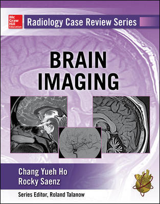 Brain Imaging(Radiology Case Review Series)
