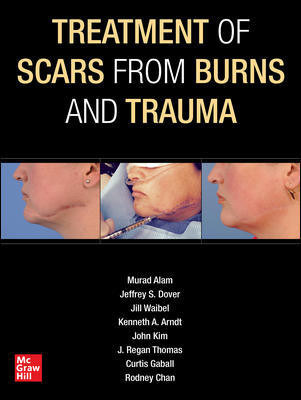 Treatment of Scars from Burns & Trauma