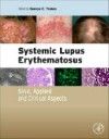Systemic Lupus Erythematosus- Basic, Applied and Clinical Aspects