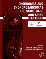 Chordomas & Chondrosarcomas of the Skull Base & Spine,2nd ed.