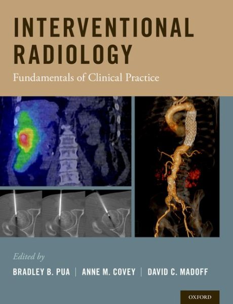 Interventional Radiology- Fundamentals of Clinial Practice