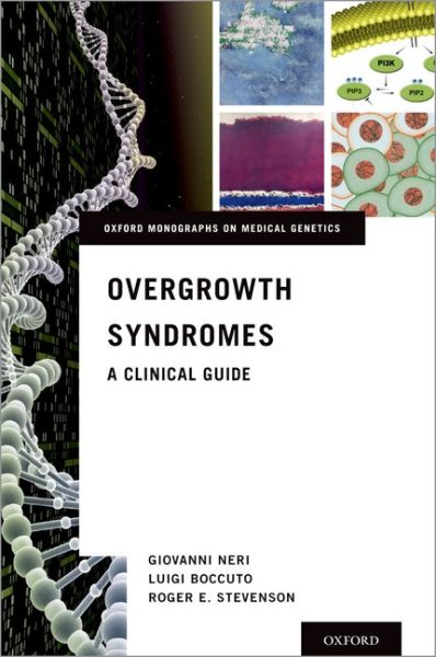 Overgrowth Syndromes- A Clinical Guide