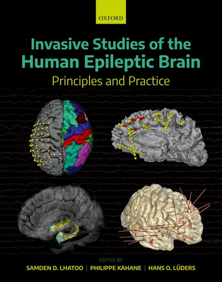 Invasive Studies of the Human Epileptic Brain- Principles & Practice