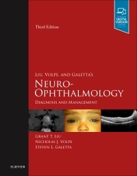 Liu, Volpe & Galetta's Neuro-Ophthalmology, 3rd ed.- Diagnosis & Management