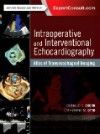 Intraoperative & Interventional Echocardiology, 2nd ed.- Atlas of Transesophageal Imaging