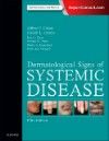 Dermatological Signs of Systemic Disease, 5th ed.