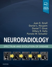 Neuroradiology- Spectrum and Evolution of Disease