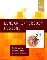 Lumbar Interbody Fusion