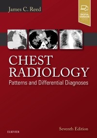 Chest Radiology, 7th ed.- Patterns & Differential Diagnoses