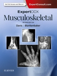 Expert Differential Diagnoses: Musculoskeletal, 2nd ed.
