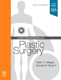 Core Procedures in Plastic Surgery, 2nd ed.