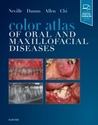 Color Atlas of Oral & Maxillofacial Diseases