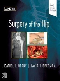 Surgery of the Hip, 2nd ed.