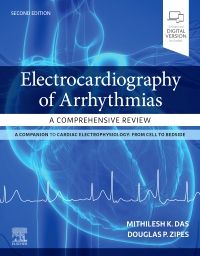Electrocardiography of Arrhythmias, 2nd ed.- A Comprehensive Review