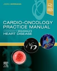 Cardio-Oncology Practice Manual- Companion to Braunwald's Heart Disease