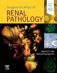 Diagnostic Atlas of Renal Pathology, 4th ed.