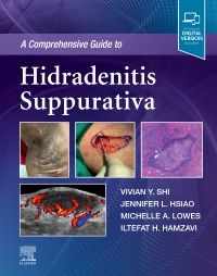 Comprehensive Guide to Hidradenitis Suppurativa