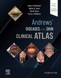 Andrews' Diseases of the Skin, 2nd ed.- Clinical Atlas