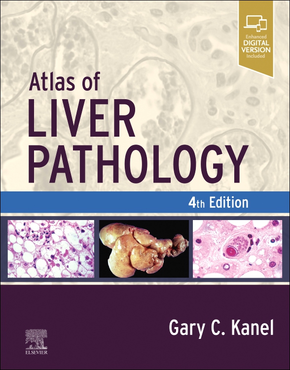 Atlas of Liver Pathology, 4th ed.