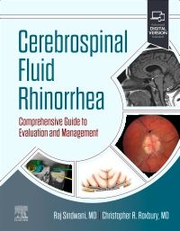 Cerebrospinal Fluid Rhinorrhea- Comprehensive Guide to Evaluation & Management