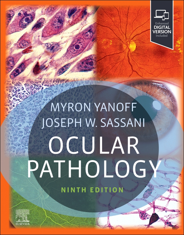 Ocular Pathology, 9th ed.