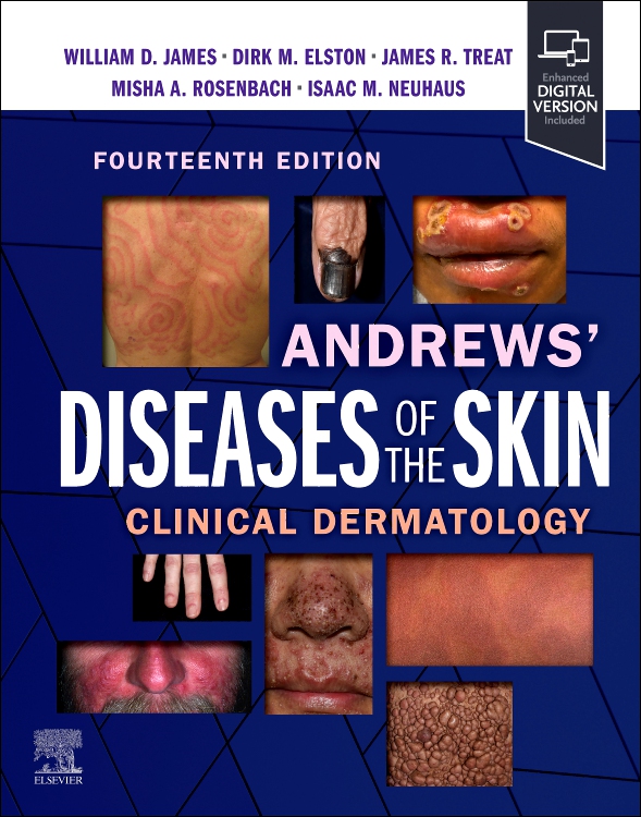 Andrews' Diseases of the Skin, 14th ed.- Clinical Dermatology