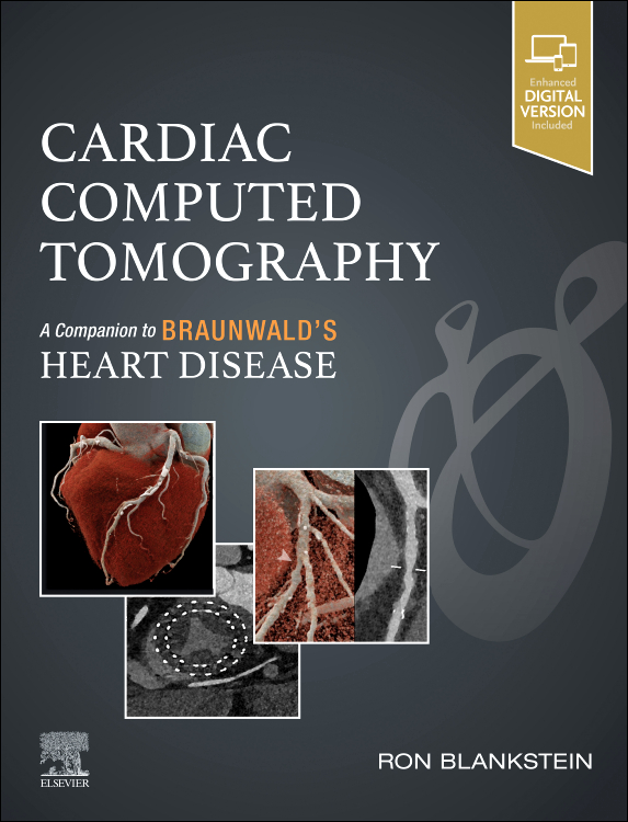 Cardiac Computed Tomography- Companion to Braunwald's Heart Disease