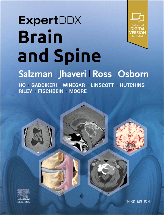 Expert Differential Diagnoses: Brain & Spine, 3rd ed.