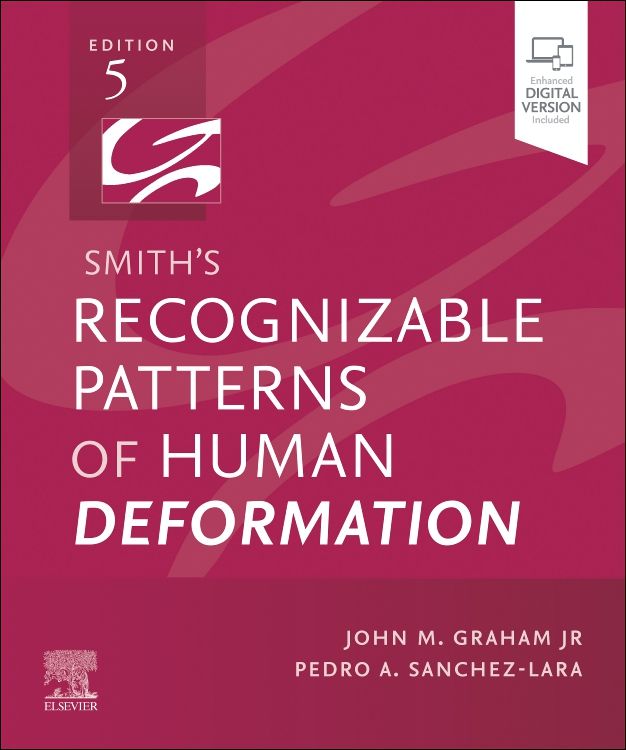 Smith's Recognizable Patterns of Human Deformation, 5thEd.