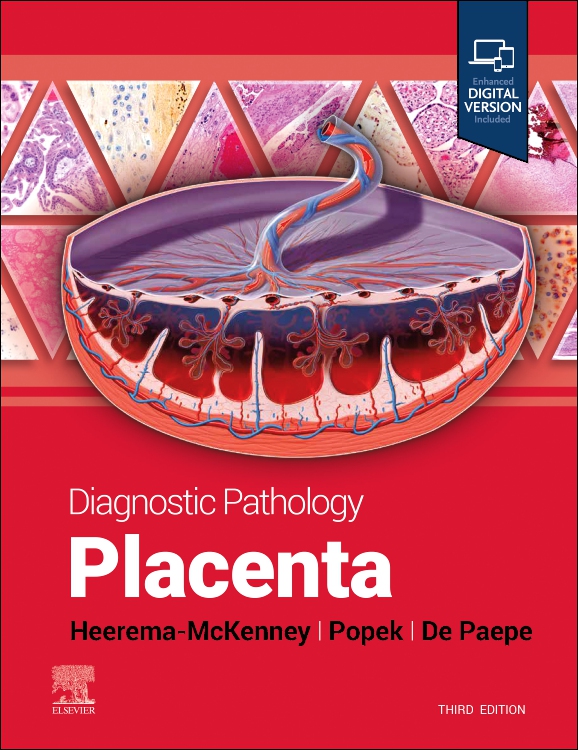 Diagnostic Pathology: Placenta, 3rd ed.