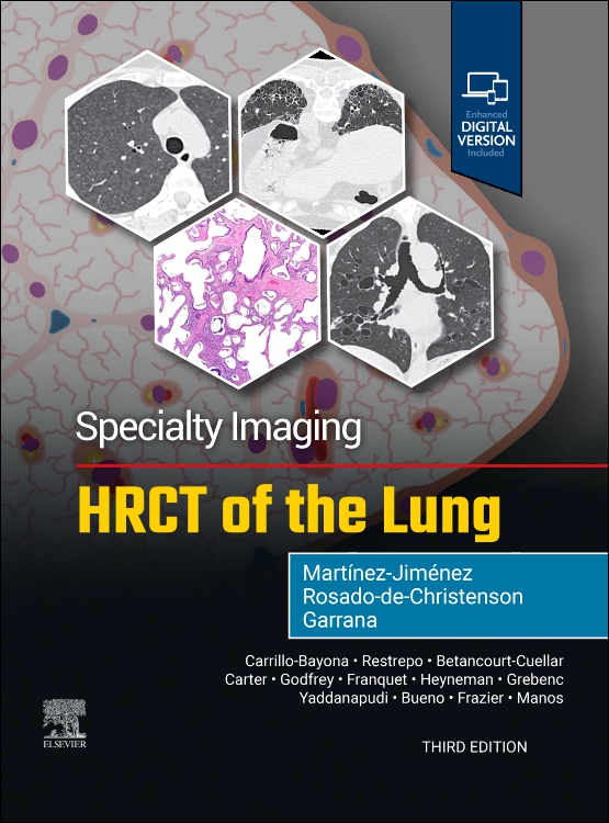 HRCT of the Lung, 3rd ed.(Specialty Imaging Series)