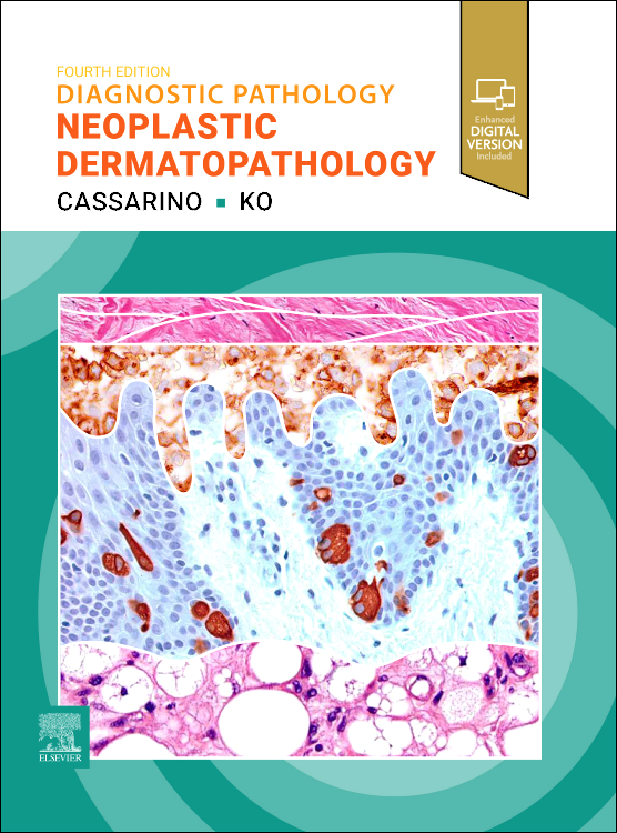 Diagnostic Pathology: Neoplastic Dermatopathology,4th ed.