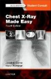 Chest X-Ray Made Easy, 4th ed.
