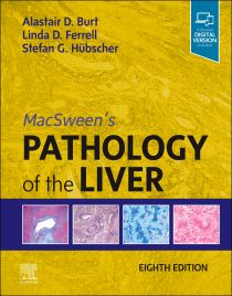 MacSween's Pathology of Liver, 8th ed.