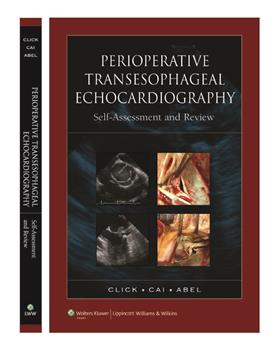 Perioperative Transesophageal EchocardiographySelf-Assessment & Review