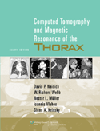Computed Tomography & Magnetic Resonance of the Thorax,4th ed.
