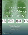 Imaging of Pulmonary Infections