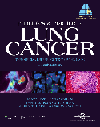 Principles & Practice of Lung Cancer, 4th ed.- Official Reference Text of IASLC