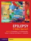Epilepsy- A Global Approach