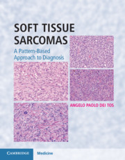 Soft Tissue Sarcomas- Pattern-Based Approach to Diagnosis