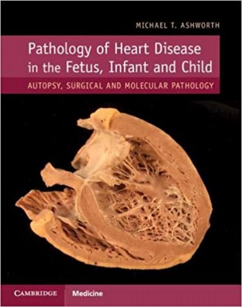 Pathology of Heart Disease in Fetus, Infant & ChildAutopsy, Surgical & Molecular Pathology