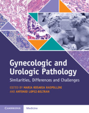 Gynecologic & Urologic Pathology- Similarities, Differences & Challenges