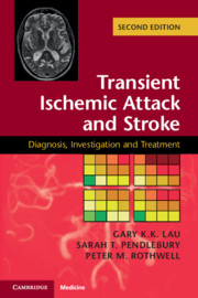 Transient Ischemic Attack & Stroke, 2nd ed.- Diagnosis, Investigation & Treatment
